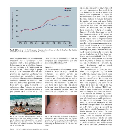 Le cancer, un fardeau mondial - IARC