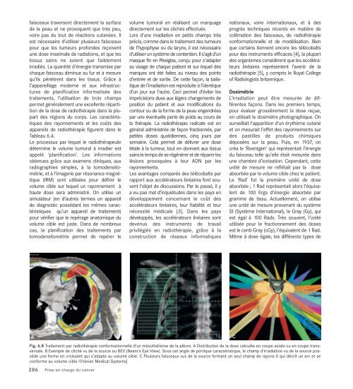 Le cancer, un fardeau mondial - IARC