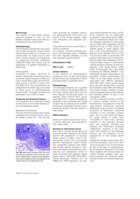 Invasive breast carcinoma - IARC