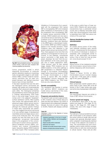 Invasive breast carcinoma - IARC