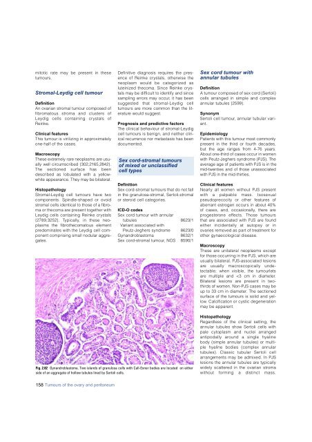 Invasive breast carcinoma - IARC