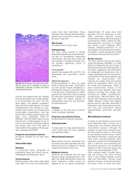 Invasive breast carcinoma - IARC