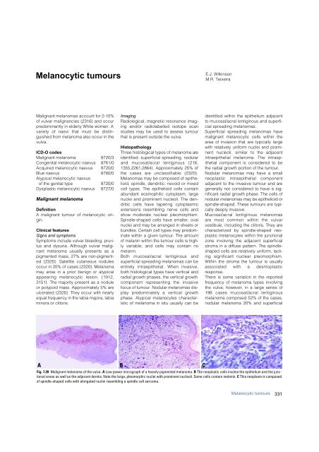 Invasive breast carcinoma - IARC