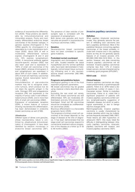 Invasive breast carcinoma - IARC
