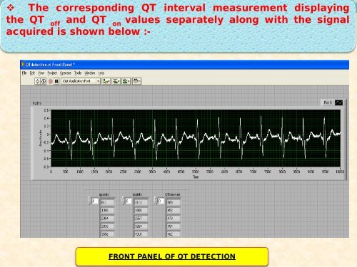 an improved method of measurement of ecg parameters for ... - ICMCC