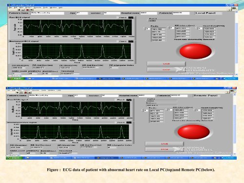 an improved method of measurement of ecg parameters for ... - ICMCC