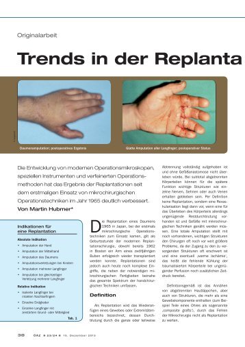 Trends in der Replanta tionschir