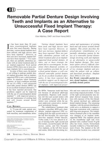 Removable Partial Denture Design Involving Teeth and ... - Id-sc.com