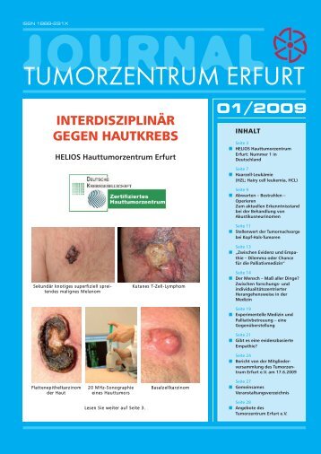 Heft 1/2009 - Tumorzentrum Erfurt eV