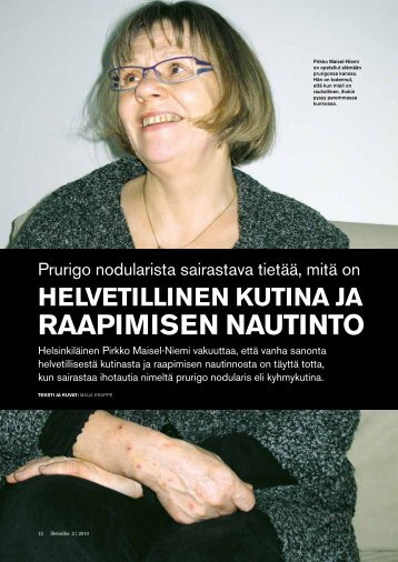 Prurigo nodularis - helvetillistÃ¤ kutinaa ja raapimisen nautintoa