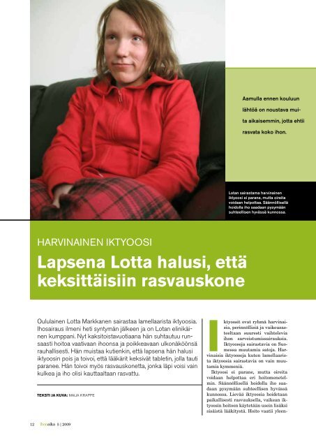 Harvinainen iktyoosi
