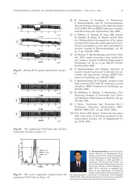 Discrete Wavelet Transform-based Baseline Wandering ... - ijabme.org