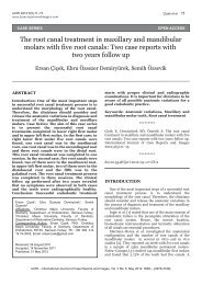 The root canal treatment in maxillary and mandibular molars with ...