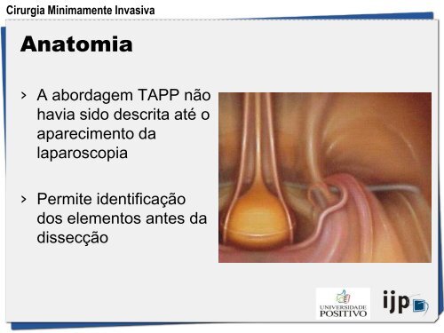 HÃ©rnia Inguinal a TAPP - IJP