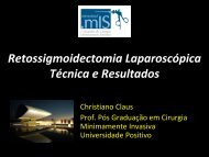 Retossigmoidectomia LaparoscÃ³pica TÃ©cnica e Resultados - IJP