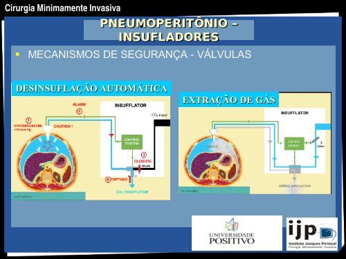 CIRURGIA MINIMAMENTE INVASIVA - IJP