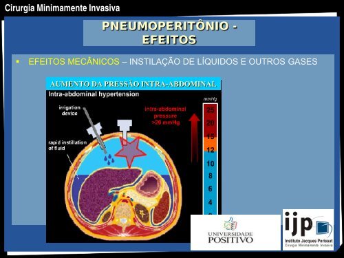 CIRURGIA MINIMAMENTE INVASIVA - IJP