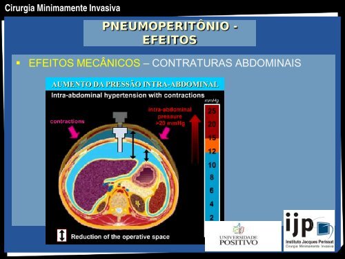 CIRURGIA MINIMAMENTE INVASIVA - IJP