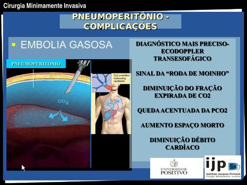 CIRURGIA MINIMAMENTE INVASIVA - IJP