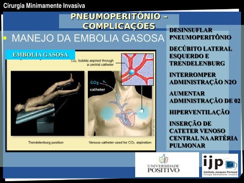 CIRURGIA MINIMAMENTE INVASIVA - IJP