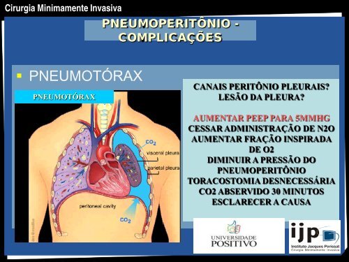 CIRURGIA MINIMAMENTE INVASIVA - IJP