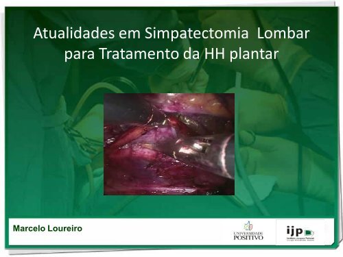 Simpatectomia Lombar - IJP