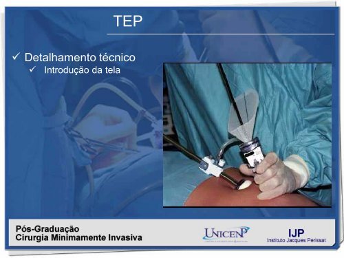 Hernioplastia inguinal TÃ©cnica TEP - IJP