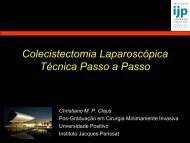 Colecistectomia LaparoscÃ³pica TÃ©cnica Passo a Passo - IJP