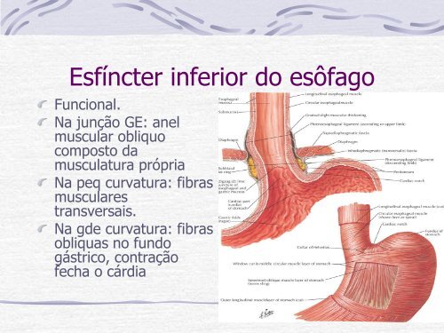 Videocirurgia EsÃ´fago-GÃ¡strica. - IJP