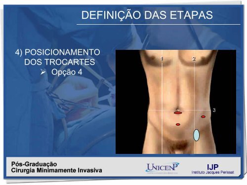 SistematizaÃ§Ã£o da TÃ©cnica TEP - IJP