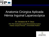 Anatomia CirÃºrgica Aplicada HÃ©rnia Inguinal LaparoscÃ³pica - IJP