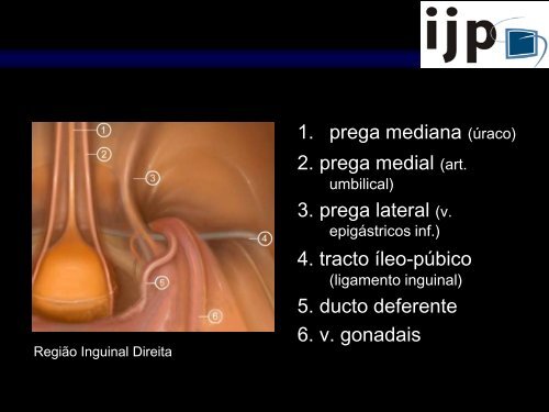 Anatomia CirÃºrgica Aplicada HÃ©rnia Inguinal LaparoscÃ³pica - IJP