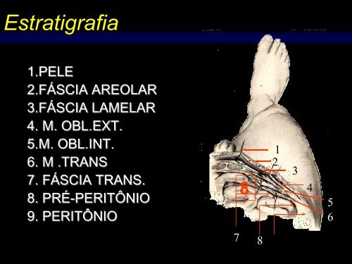 Anatomia CirÃºrgica Aplicada HÃ©rnia Inguinal LaparoscÃ³pica - IJP