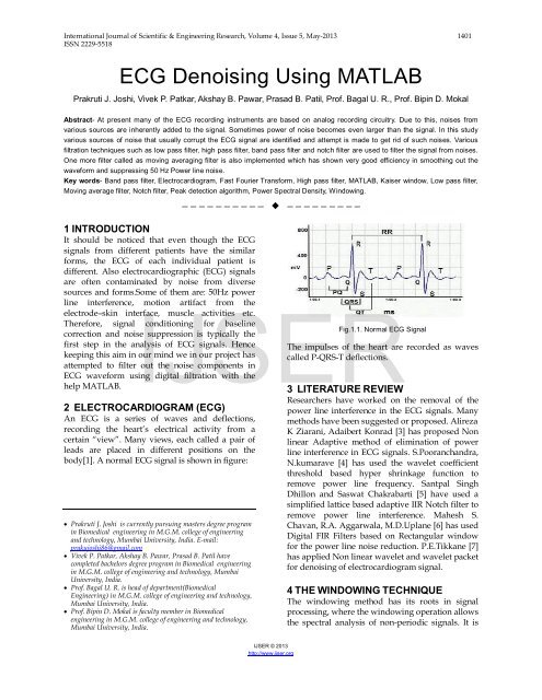 denoising ecg signal using wavelet matlab code denoising ecg signal using wavelet matlab code