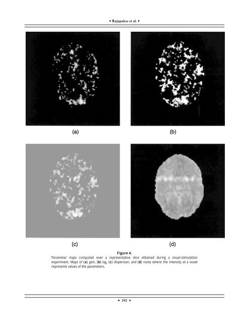 Modeling hemodynamic response for analysis of functional MRI time ...