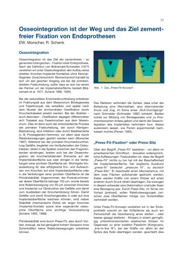 EW. Morscher, R. Schenk - Implantat - Atlas Zementfreie HÃ¼ftpfannen