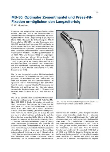 135-143 Morscher MS 30 - Implantat - Atlas Zementfreie HÃ¼ftpfannen