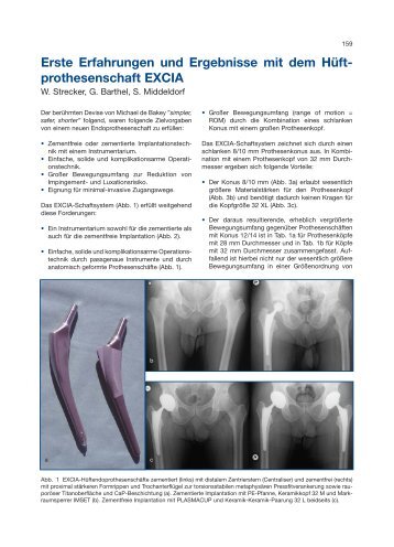 Prothesenschaft EXCIA - Implantat - Atlas Zementfreie HÃ¼ftpfannen