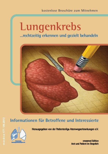 Lungenkrebs - patienten-bibliothek.de