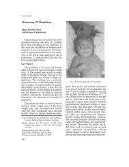 Monosomy 22 Mosaicism - Indian Pediatrics