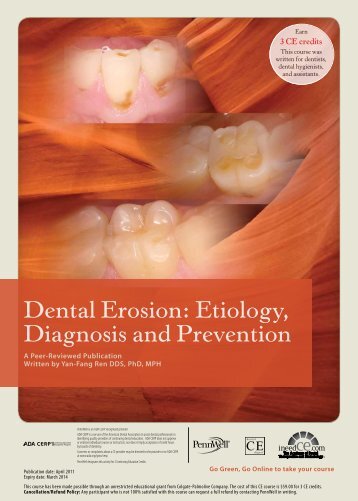 Dental Erosion: Etiology, Diagnosis and Prevention - IneedCE.com