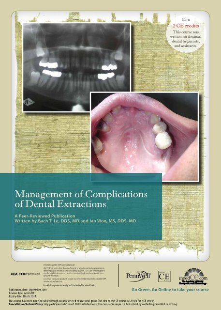 Management of Complications of Dental Extractions - IneedCE.com