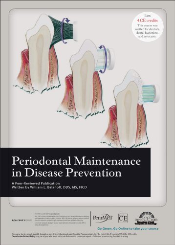 Periodontal Maintenance in Disease Prevention - IneedCE.com