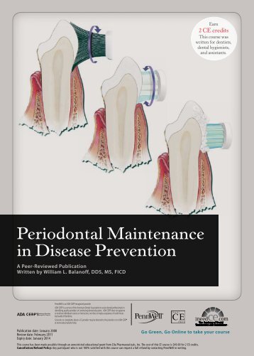Periodontal Maintenance in Disease Prevention - IneedCE.com