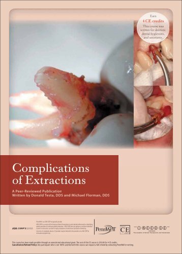 Complications of Extractions - IneedCE.com