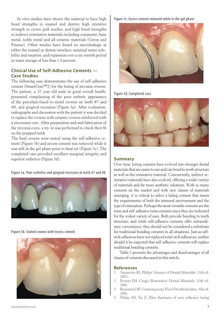 A Practical Guide to the Use of Luting Cements - IneedCE.com