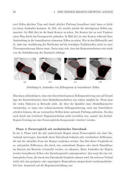 Großer Beleg Segmentierung von ATPase-gefärbten - Fakultät ...