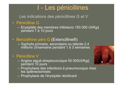 Principales Ã-lactamines : PÃ©nicillines G, A, M ... - Infectiologie