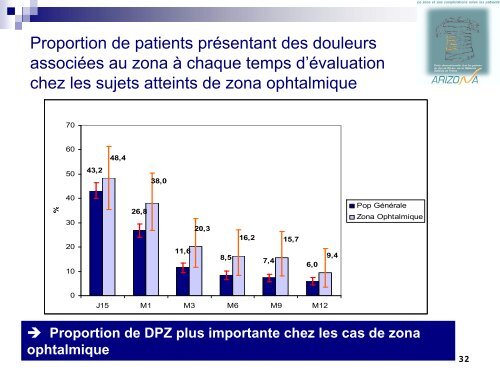 Le zona - Infectiologie