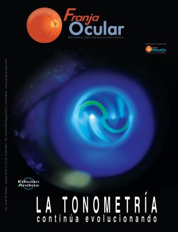 Franja Ocular 87